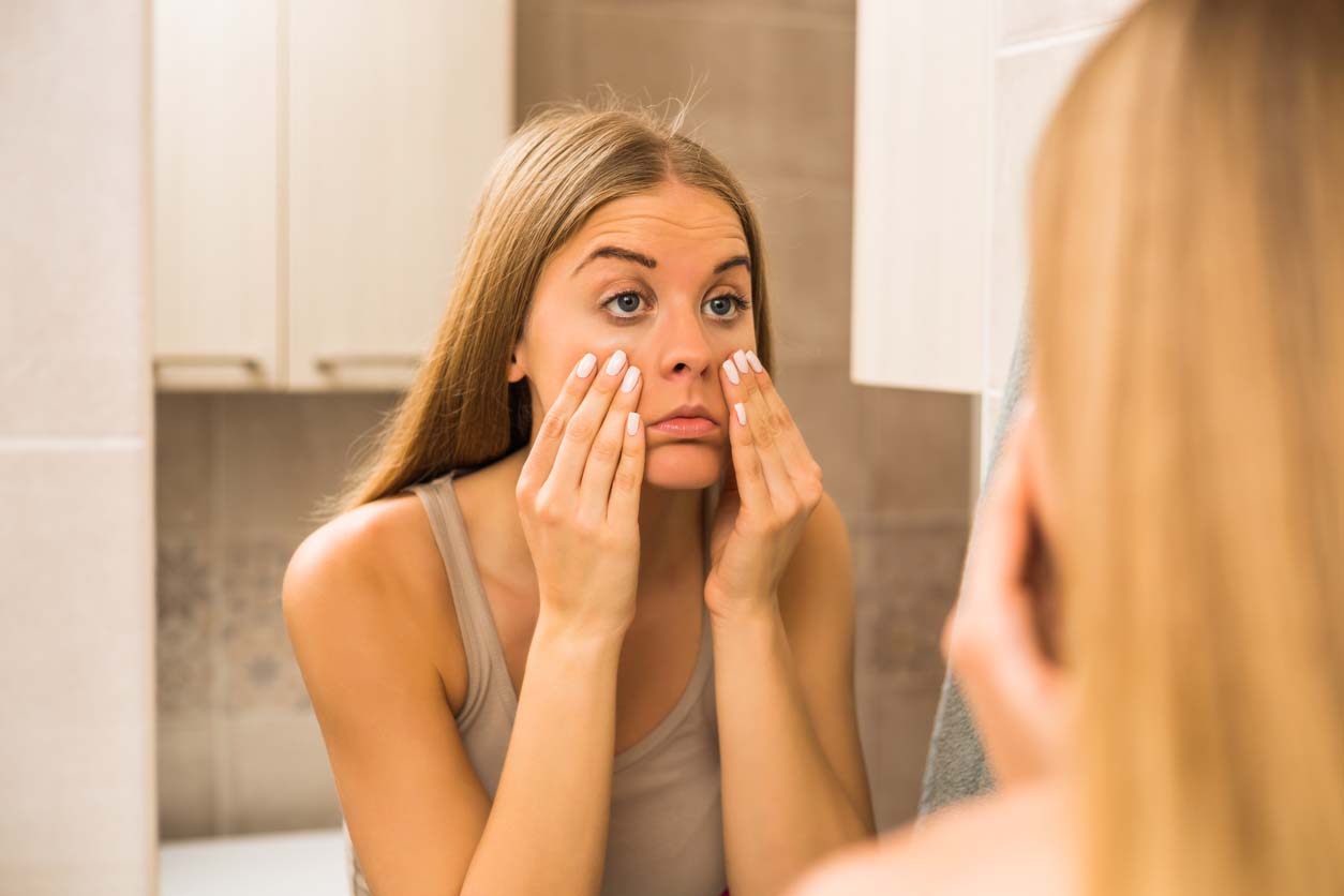 Adrenal Fatigue – Or is it? Woman looking eye bags