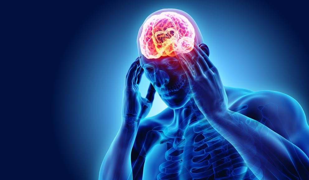Migraine Prevention with Holistic Medicine